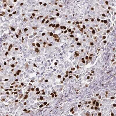 Immunohistochemistry-Paraffin: Anillin Antibody (CL0301) [NBP2-52907]
