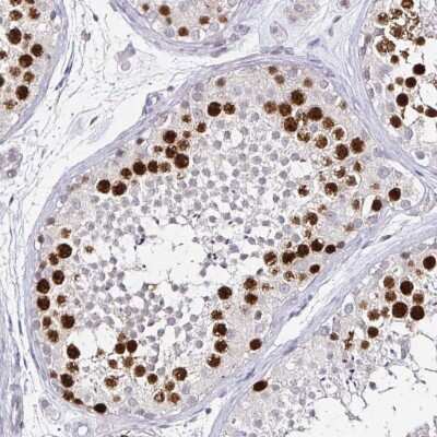 Immunohistochemistry-Paraffin: Anillin Antibody (CL0301) [NBP2-52907]