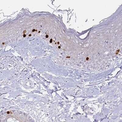 Immunohistochemistry-Paraffin: Anillin Antibody (CL0301) [NBP2-52907]