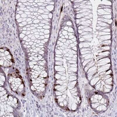 Immunohistochemistry-Paraffin: Anillin Antibody (CL0301) [NBP2-52907]