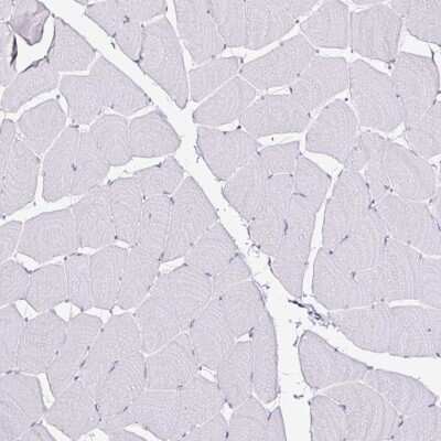 Immunohistochemistry-Paraffin: Anillin Antibody (CL0301) [NBP2-52907]