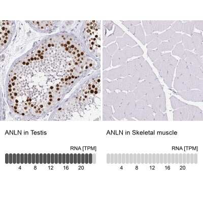 Immunohistochemistry-Paraffin: Anillin Antibody (CL0301) [NBP2-52907]