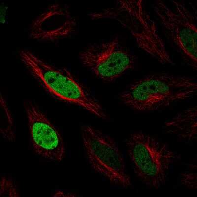 Immunocytochemistry/ Immunofluorescence: Anillin Antibody (CL0303) [NBP2-52908]