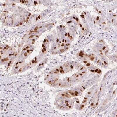 Immunohistochemistry-Paraffin: Anillin Antibody (CL0303) [NBP2-52908]
