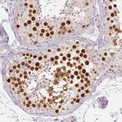 Immunohistochemistry-Paraffin: Anillin Antibody (CL0303) [NBP2-52908]