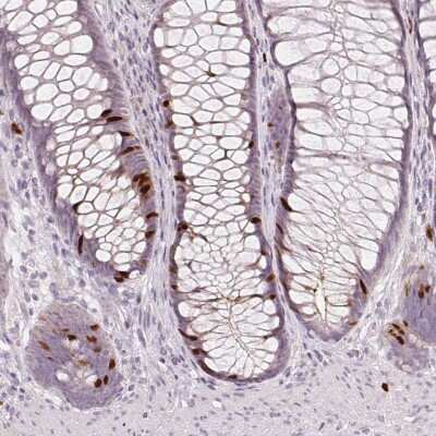 Immunohistochemistry-Paraffin: Anillin Antibody (CL0303) [NBP2-52908]