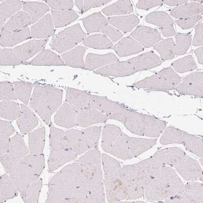 Immunohistochemistry-Paraffin: Anillin Antibody (CL0303) [NBP2-52908]