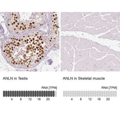 Immunohistochemistry-Paraffin: Anillin Antibody (CL0303) [NBP2-52908]