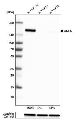 Western Blot: Anillin Antibody (CL0303) [NBP2-52908]
