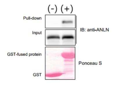 Western Blot: Anillin Antibody (CL0303) [NBP2-52908]