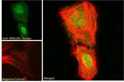 Immunocytochemistry/ Immunofluorescence: Anillin Antibody [NB100-1314]