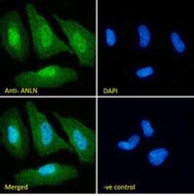 Immunocytochemistry/ Immunofluorescence: Anillin Antibody [NB100-41099]