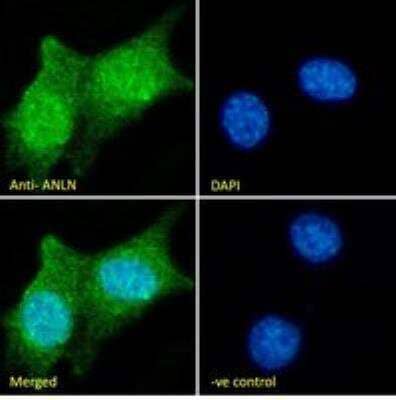 Immunocytochemistry/ Immunofluorescence: Anillin Antibody [NB100-41099]