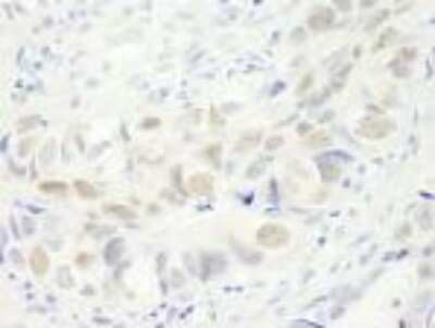 Immunohistochemistry-Paraffin: Anillin Antibody [NB100-68216]