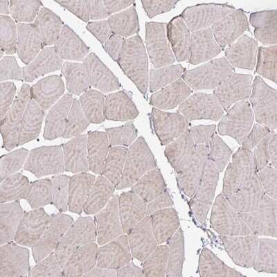 Immunohistochemistry-Paraffin: Anillin Antibody [NBP2-33857]