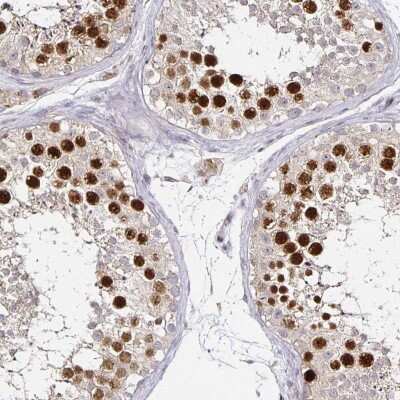 Immunohistochemistry-Paraffin: Anillin Antibody [NBP2-33857]