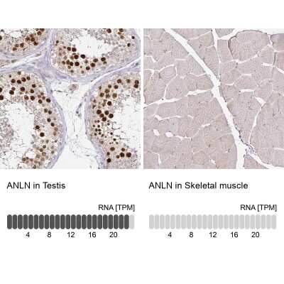 Immunohistochemistry-Paraffin: Anillin Antibody [NBP2-33857]