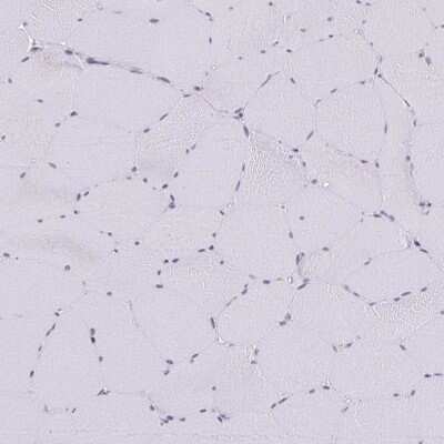 Immunohistochemistry-Paraffin: Anillin Antibody [NBP2-38630]