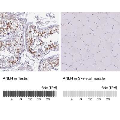 Immunohistochemistry-Paraffin: Anillin Antibody [NBP2-38630]