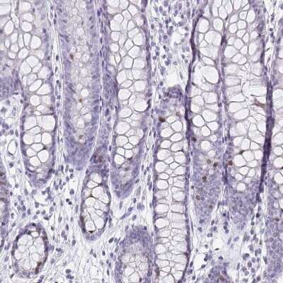 Immunohistochemistry-Paraffin: Anillin Antibody [NBP2-38630]
