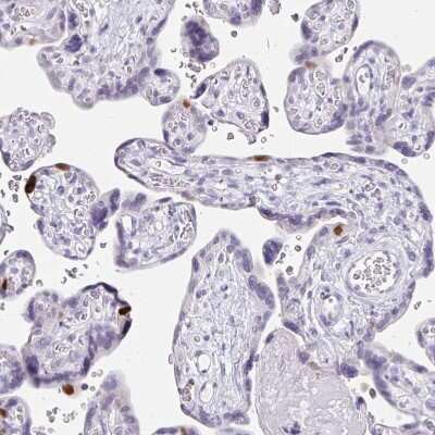 Immunohistochemistry-Paraffin: Anillin Antibody [NBP2-38630]