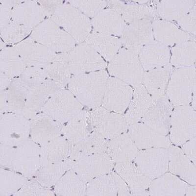Immunohistochemistry-Paraffin: Anillin Antibody [NBP2-38630]