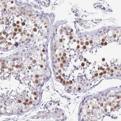 Immunohistochemistry-Paraffin: Anillin Antibody [NBP2-38630]