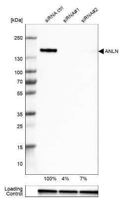 Western Blot: Anillin Antibody [NBP2-33857]