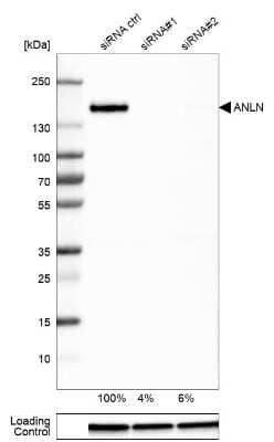 Western Blot: Anillin Antibody [NBP2-38630]