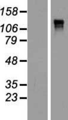 Western Blot: Anillin Overexpression Lysate [NBP2-06787]