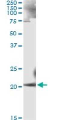 Immunoprecipitation: Ankyrin 1 Antibody (3C3) [H00000286-M01]