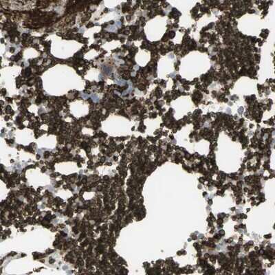 Immunohistochemistry-Paraffin: Ankyrin 1 Antibody [NBP1-90168]