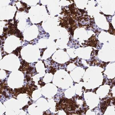 Immunohistochemistry-Paraffin: Ankyrin 1 Antibody [NBP2-33806]