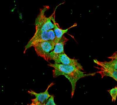 Immunocytochemistry/ Immunofluorescence: Ankyrin 1 Antibody (S388A-10) [NBP2-59315]