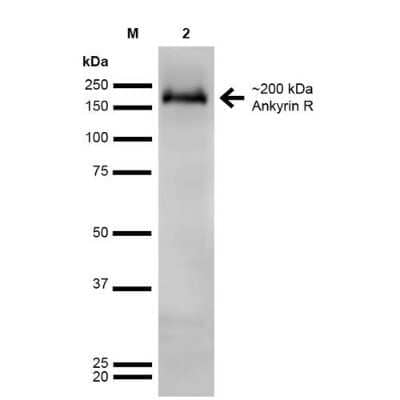 Western Blot: Ankyrin 1 Antibody (S388A-10) [NBP2-59315]