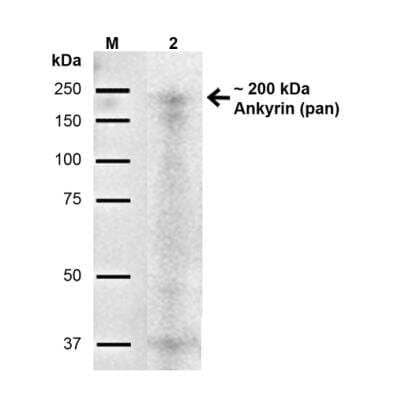 Western Blot: Ankyrin 1 Antibody (S388A-60) [NBP2-59316]