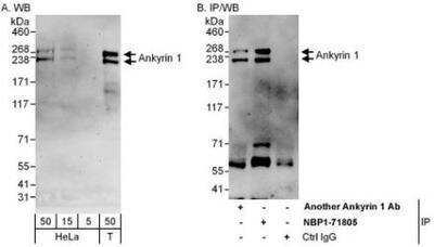 Western Blot: Ankyrin 1 Antibody [NBP1-71805]