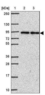 Western Blot: Ankyrin 1 Antibody [NBP2-33806]