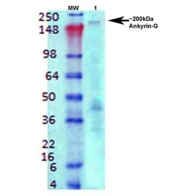 Western Blot: Ankyrin 3 Antibody (S106-20) [NBP2-59310]