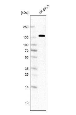 Western Blot: Ankyrin 3 Antibody [NBP2-58275]