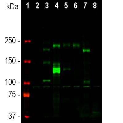 Western Blot: Ankyrin 3 Antibody [NBP3-05528]