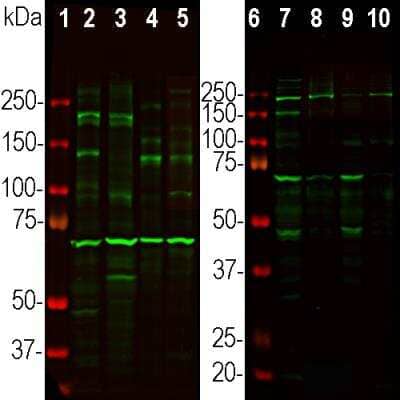 Western Blot: Ankyrin 3 Antibody [NBP3-05549]