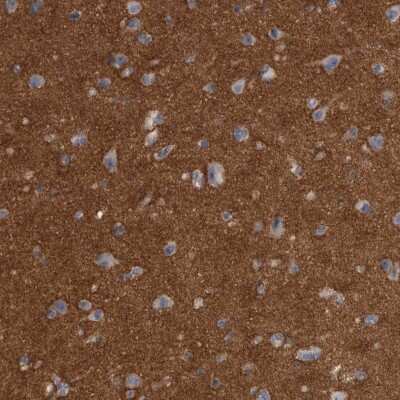 Immunohistochemistry-Paraffin: Ankyrin Brain Antibody [NBP2-33863]