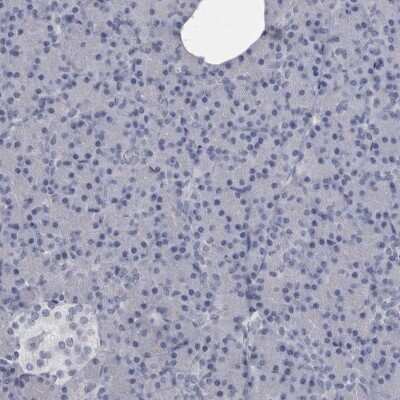 Immunohistochemistry-Paraffin: Ankyrin Brain Antibody [NBP2-33863]