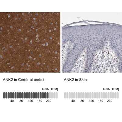 Immunohistochemistry-Paraffin: Ankyrin Brain Antibody [NBP2-33863]