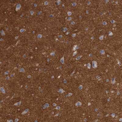 Immunohistochemistry-Paraffin: Ankyrin Brain Antibody [NBP2-33863]