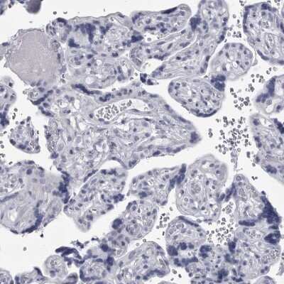 Immunohistochemistry-Paraffin: Ankyrin Brain Antibody [NBP2-33863]