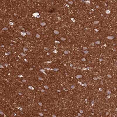 Immunohistochemistry-Paraffin: Ankyrin Brain Antibody [NBP2-34023]