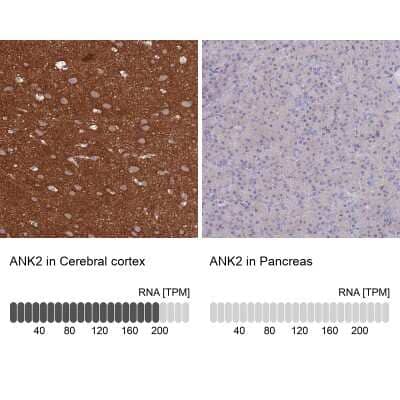 Immunohistochemistry-Paraffin: Ankyrin Brain Antibody [NBP2-34023]