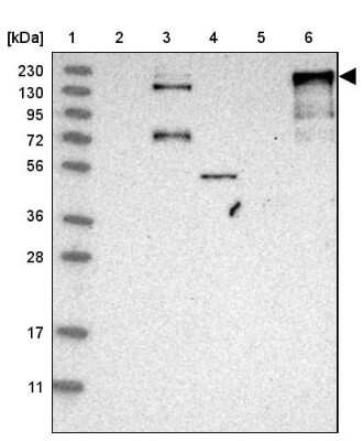 Western Blot: Ankyrin Brain Antibody [NBP2-33863]